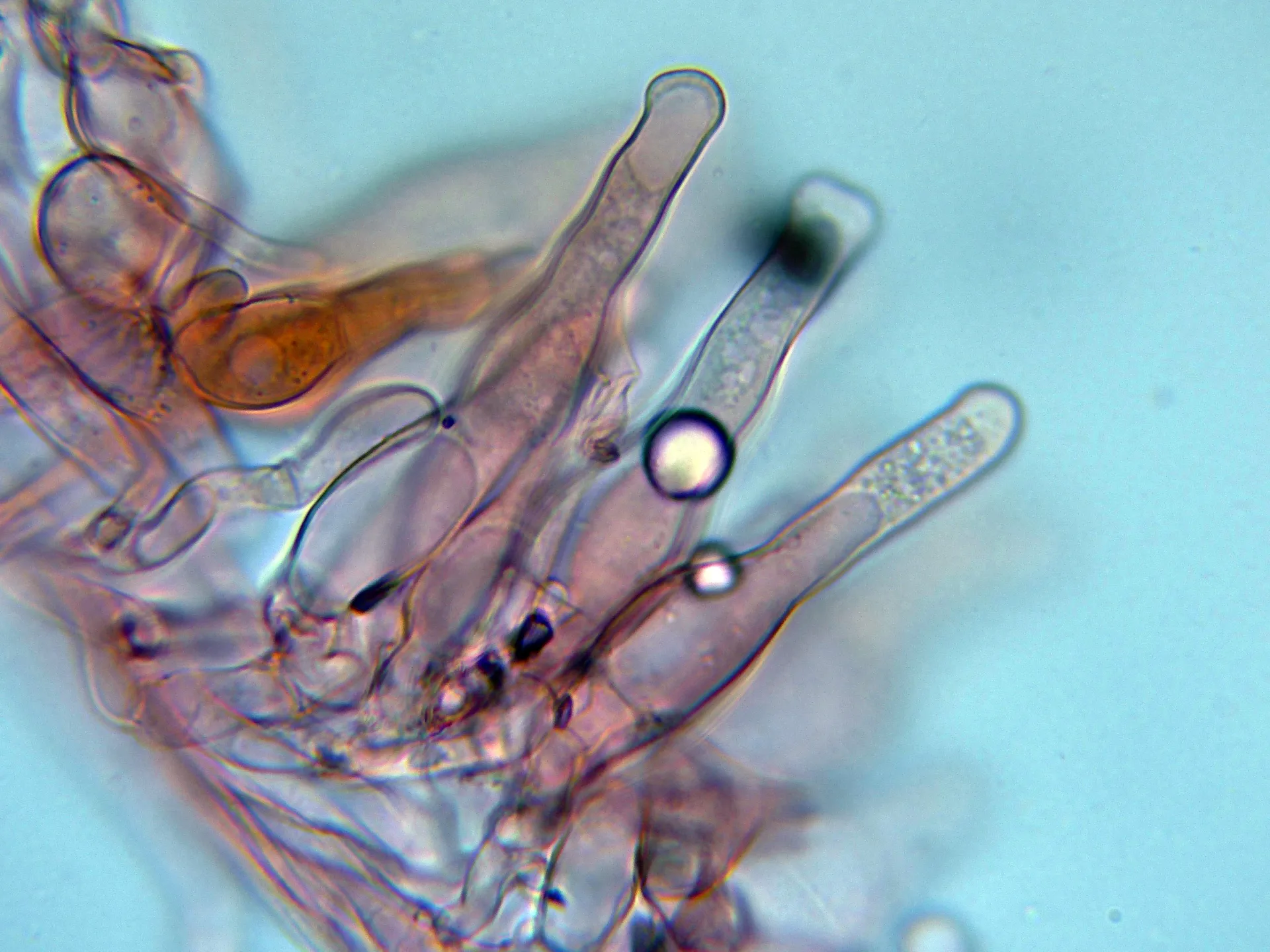 Microscopía de Psathyrella calcarea - 10 - Caulocistidios-003